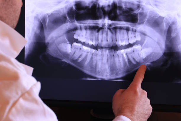 Best Weekend Emergency Dentist in Mount Ephraim, NJ