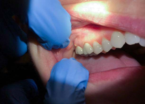Best Emergency Dentist for Special Needs Patients in Mount Ephraim, NJ