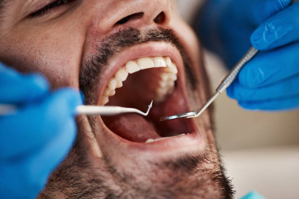 Best Broken or Cracked Tooth Emergency Dentist in Mount Ephraim, NJ
