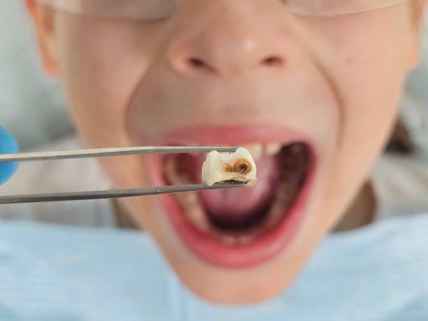 Best Urgent Dental Care for Toothache in Mount Ephraim, NJ